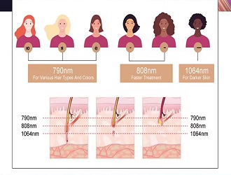 790/808/1060nm in one handle for all hair colors and skin types, including dark skin.